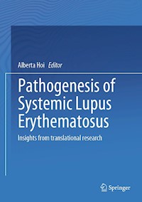 Pathogenesis of Systemic Lupus Erythematosus -  - E-Book