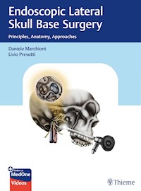 Endoscopic Lateral Skull Base Surgery -  - E-Book