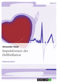 Impulsformen der Defibrillation - Alexander Haub - E-Book