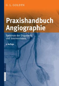 Praxishandbuch Angiographie - Gerd L. Goldyn - E-Book