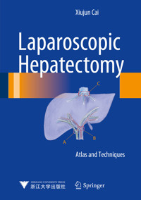 Laparoscopic Hepatectomy - Xiujun Cai - E-Book