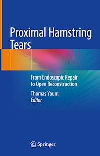 Proximal Hamstring Tears -  - E-Book