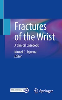 Fractures of the Wrist -  - E-Book