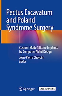 Pectus Excavatum and Poland Syndrome Surgery -  - E-Book