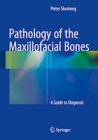Pathology of the Maxillofacial Bones - Pieter Slootweg - E-Book