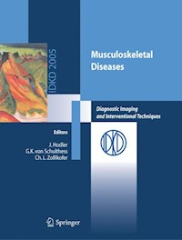 Musculoskeletal Diseases -  - E-Book