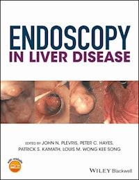 Endoscopy in Liver Disease -  - E-Book