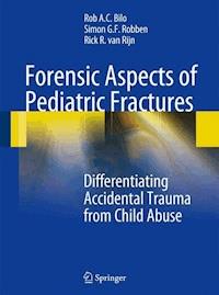 Forensic Aspects of Pediatric Fractures - Rob A. C. Bilo - E-Book