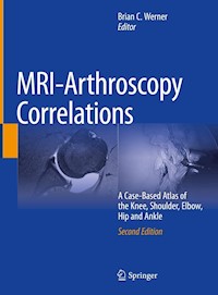 MRI-Arthroscopy Correlations -  - E-Book