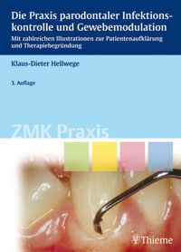 Die Praxis parodontaler Infektionskontrolle und Gewebemodulation - Klaus-Dieter Hellwege - E-Book