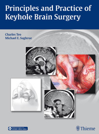 Principles and Practice of Keyhole Brain Surgery - Charles Teo - E-Book
