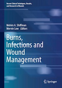 Burns, Infections and Wound Management -  - E-Book