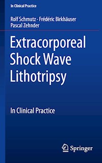 Extracorporeal Shock Wave Lithotripsy - Rolf Schmutz - E-Book