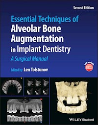 Essential Techniques of Alveolar Bone Augmentation in Implant Dentistry -  - E-Book
