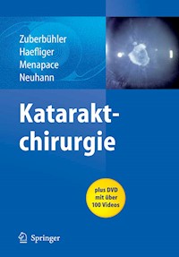 Kataraktchirurgie - Bruno Zuberbuhler - E-Book