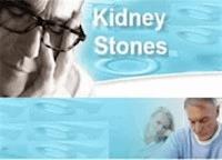 51 Tips for Dealing Kidney Stones - Ouvrage Collectif - E-Book