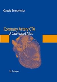 Coronary Artery CTA - Claudio Smuclovisky - E-Book
