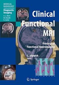 Clinical Functional MRI -  - E-Book