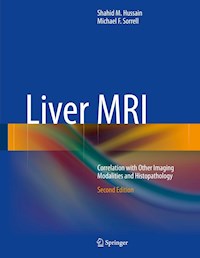 Liver MRI - Shahid M. Hussain - E-Book