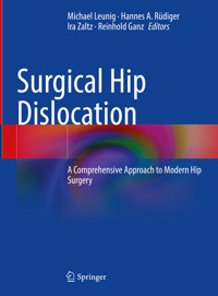 Surgical Hip Dislocation -  - E-Book