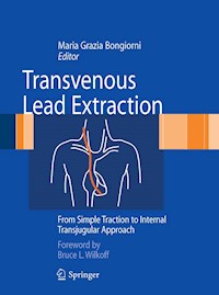 Transvenous Lead Extraction -  - E-Book