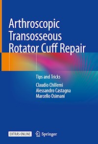 Arthroscopic Transosseous Rotator Cuff Repair - Claudio Chillemi - E-Book