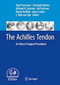 The Achilles Tendon -  - E-Book