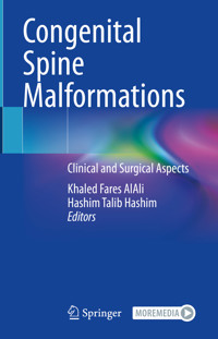 Congenital Spine Malformations -  - E-Book