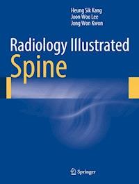 Radiology Illustrated: Spine - Heung Sik Kang - E-Book