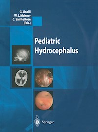 Pediatric Hydrocephalus -  - E-Book