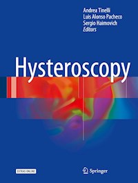 Hysteroscopy -  - E-Book