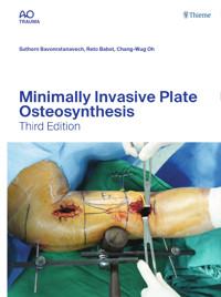 Minimally Invasive Plate Osteosynthesis - Suthorn Bavonratanavech - E-Book