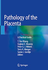 Pathology of the Placenta -  - E-Book