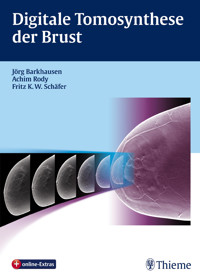 Digitale Tomosynthese der Brust -  - E-Book