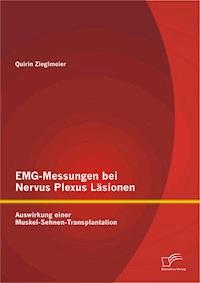 EMG-Messungen bei Nervus Plexus Läsionen: Auswirkung einer Muskel-Sehnen-Transplantation - Quirin Zieglmeier - E-Book