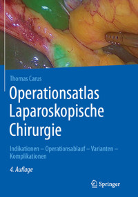 Operationsatlas Laparoskopische Chirurgie - Thomas Carus - E-Book