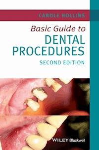 Basic Guide to Dental Procedures - Carole Hollins - E-Book