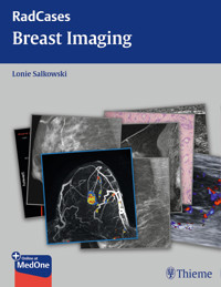 Radcases Breast Imaging - Lonie L. Salkowski - E-Book