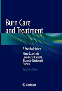 Burn Care and Treatment -  - E-Book