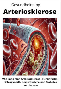 Gesundheitstipp Arteriosklerose - Maximilian Loidl - E-Book