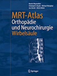 MRT-Atlas - Martin Weyreuther - E-Book