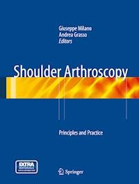 Shoulder Arthroscopy -  - E-Book