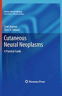 Cutaneous Neural Neoplasms - Zsolt Argenyi - E-Book