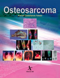 Osteosarcoma - Araceli Castellanos Toledo - E-Book