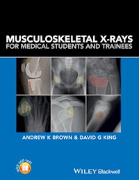 Musculoskeletal X-Rays for Medical Students and Trainees - Andrew K. Brown - E-Book