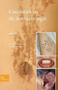 Casuïstiek in de dermatologie - deel 2 - Johan Toonstra - E-Book