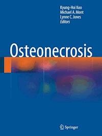 Osteonecrosis -  - E-Book