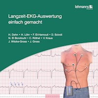 Langzeit-EKG-Auswertung einfach gemacht - Helma Dehn - E-Book