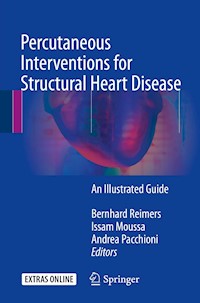 Percutaneous Interventions for Structural Heart Disease -  - E-Book