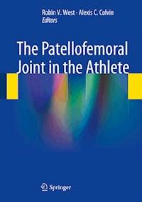 The Patellofemoral Joint in the Athlete -  - E-Book